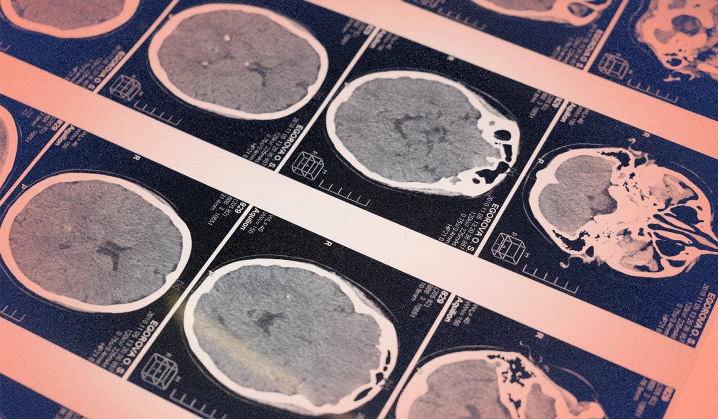 Acelerar el proceso de detección de Elastic con los LLM