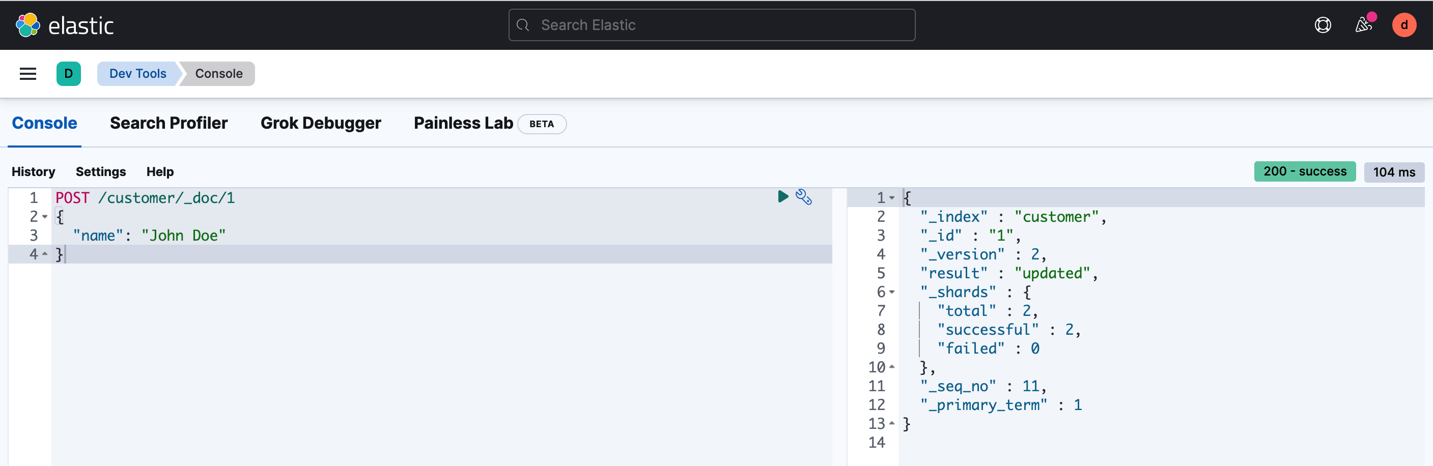 Kibana Console page